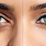 Dark Circles1