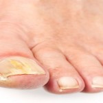 signs of disease of Pain3