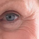For wrinkles